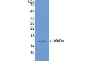 Western blot analysis of recombinant Human GDF6. (GDF6 Antikörper  (AA 336-455))