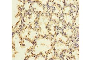 Immunohistochemistry of paraffin-embedded human lung tissue using ABIN7176105 at dilution of 1:100 (ZNF114 Antikörper  (AA 1-414))