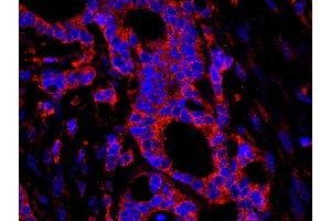 Immunofluorescence (IF) image for anti-Ubiquitin Specific Peptidase 3 (USP3) (AA 471-521) antibody (ABIN7449030) (USP3 Antikörper  (AA 471-521))