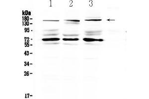 Western blot analysis of IL17RA using anti-IL17RA antibody . (IL17RA Antikörper  (AA 53-284))