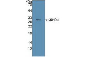 Western blot analysis of recombinant Human Ki67P. (Ki-67 Antikörper  (AA 3088-3235))