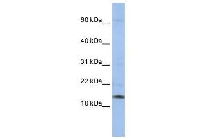 SNRPD2 antibody used at 1 ug/ml to detect target protein. (SNRPD2 Antikörper  (Middle Region))