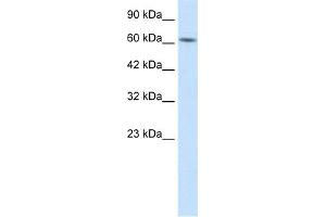WB Suggested Anti-BTBD5 Antibody Titration:  1. (KLHL28 Antikörper  (Middle Region))