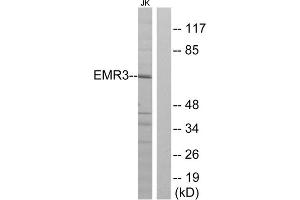 Western blot analysis of extracts from Jurkat cells, using EMR3 antibody. (EMR3 Antikörper  (C-Term))