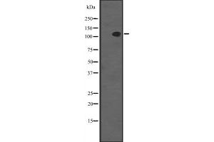 Western blot analysis of SYCP1 expression in MCF7 whole cell lysate ,The lane on the left is treated with the antigen-specific peptide.