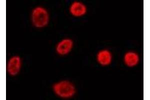 ABIN6274011 staining Hela by IF/ICC. (FUBP1 Antikörper  (C-Term))