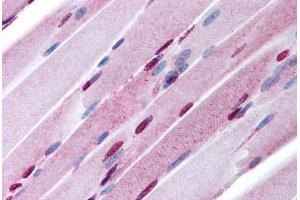 anti-Sal-Like 4 (SALL4) (AA 28-42) antibody