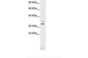 Image no. 1 for anti-Visual System Homeobox 2 (VSX2) (AA 234-283) antibody (ABIN6735777) (VSX2 Antikörper  (AA 234-283))