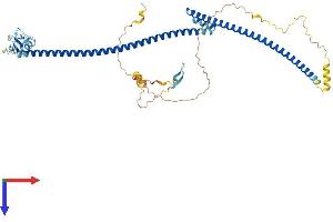 TRAIP Protein (AA 1-470) (His tag)