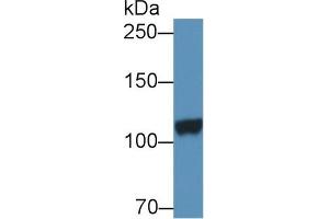 Detection of DPP6 in Porcine Cerebrum lysate using Polyclonal Antibody to Dipeptidyl Peptidase 6 (DPP6) (DPP6 Antikörper  (AA 667-865))