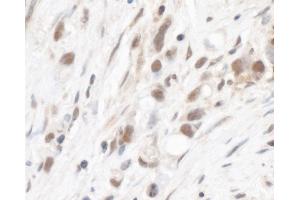 Immunohistochemistry (IHC) image for anti-Ribosomal Protein L5 (RPL5) (AA 247-297) antibody (ABIN7454984) (RPL5 Antikörper  (AA 247-297))