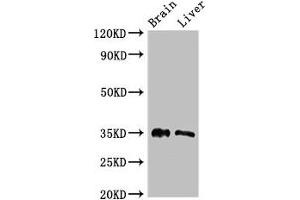 Western Blot Positive WB detected in: Mouse brain tissue, Rat liver tissue All lanes: PTF1A antibody at 2. (PTF1A Antikörper  (AA 224-325))
