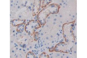 Immunohistochemistry (IHC) image for anti-Transporter 1, ATP-Binding Cassette, Sub-Family B (MDR/TAP) (TAP1) (AA 525-808) antibody (ABIN1871341)