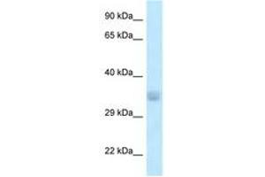 Image no. 1 for anti-Acyl-CoA Thioesterase 8 (ACOT8) (N-Term) antibody (ABIN6747608) (ACOT8 Antikörper  (N-Term))