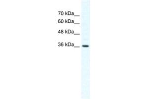 Western Blotting (WB) image for anti-Dishevelled Segment Polarity Protein 1 (DVL1) antibody (ABIN2460375) (DVL1 Antikörper)