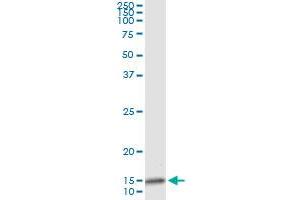 Immunoprecipitation of IL8 transfected lysate using anti-IL8 monoclonal antibody and Protein A Magnetic Bead , and immunoblotted with IL8 MaxPab rabbit polyclonal antibody. (IL-8 Antikörper  (AA 21-99))
