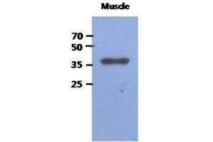 Image no. 1 for anti-Fructose-1,6-Bisphosphatase 2 (FBP2) (AA 1-339), (N-Term) antibody (ABIN1449407) (FBP2 Antikörper  (N-Term))