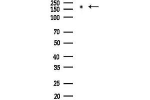 Western blot analysis of lysates from HUVEC cells(LPS 4h treatment), using EGFR Antibody at 1/1000 dilution.