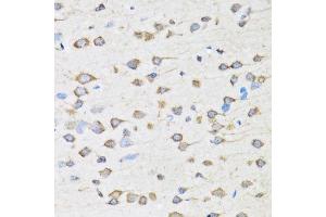 Immunohistochemistry of paraffin-embedded rat brain using COPB2 antibody.