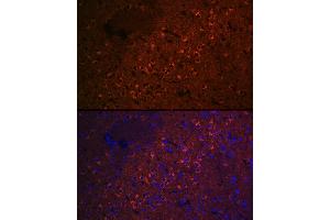 Immunofluorescence analysis of rat brain cells using CEND1 Rabbit mAb (ABIN7266242) at dilution of 1:100 (40x lens). (CEND1 Antikörper)