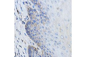 Immunohistochemistry (IHC) image for anti-CD46 (CD46) (AA 40-320) antibody (ABIN1512715)