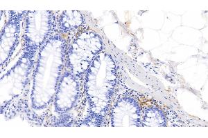 Immunohistochemistry (IHC) image for anti-Elastin (ELN) (AA 392-645) antibody (ABIN7433489)