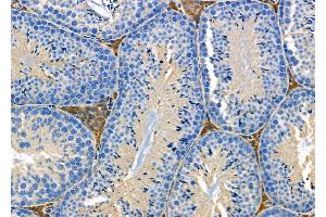 ABIN6265775 and ABIN6278239 at 1/100 staining Mouse testis tissue by IHC-P.
