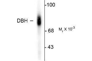 Western blots of human adrenal medulla lysate showing specific immunolabeling of the ~75k DBH protein. (DBH Antikörper  (C-Term))