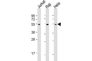 All lanes : Anti-XI Antibody at 1:1000-1:4000 dilution Lane 1: Jurkat whole cell lysates Lane 2: Raji whole cell lysates Lane 3: Hela whole cell lysates Lysates/proteins at 20 μg per lane.