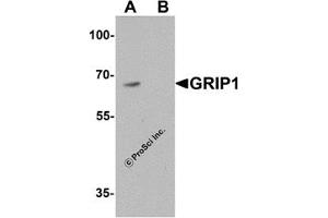 Western Blotting (WB) image for anti-Glutamate Receptor Interacting Protein 1 (GRIP1) (C-Term) antibody (ABIN1077440) (GRIP1 Antikörper  (C-Term))
