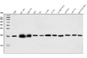 Western blot analysis of CHCHD10 using anti-CHCHD10 antibody (ABIN7602507). (CHCHD10 Antikörper  (AA 80-142))