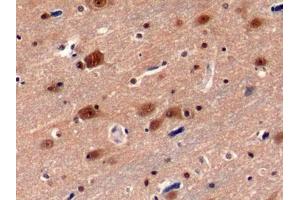 Immunohistochemistry (IHC) image for anti-Proteasome (Prosome, Macropain) 26S Subunit, ATPase, 3 (PSMC3) (AA 2-439) antibody (ABIN7442060)