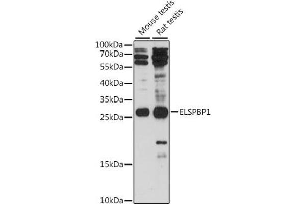 ELSPBP1 Antikörper  (AA 110-223)