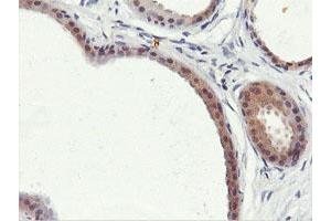 Immunohistochemical staining of paraffin-embedded Human breast tissue using anti-PNPO mouse monoclonal antibody.