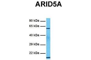 Host:  Rabbit  Target Name:  ARID5A  Sample Tissue:  Human 721_B  Antibody Dilution:  1.