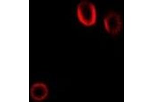 Immunofluorescent analysis of Colipase staining in Hela cells. (CLPS Antikörper)