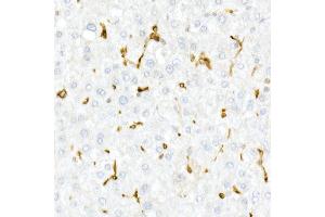 Immunohistochemistry of paraffin-embedded Human liver using CD74 antibody (ABIN6128421, ABIN6138228, ABIN6138230 and ABIN6221316) at dilution of 1:25 (40x lens). (CD74 Antikörper  (AA 73-232))