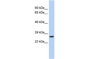 WB Suggested Anti-DIRAS1 Antibody Titration: 0. (DIRAS1 Antikörper  (Middle Region))