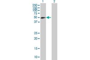 Western Blot analysis of RNF146 expression in transfected 293T cell line by RNF146 MaxPab polyclonal antibody. (RNF146 Antikörper  (AA 1-358))
