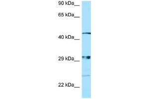 WB Suggested Anti-NPAL3 Antibody Titration: 1. (NIPAL3 Antikörper  (N-Term))