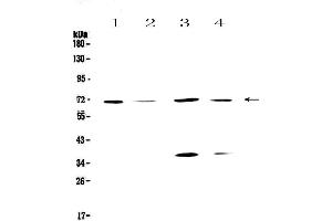Western blot analysis of DNA Polymerase lambda using anti-DNA Polymerase lambda antibody . (POLL Antikörper  (AA 307-407))