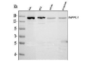 Western blot analysis of INPPL1 using anti-INPPL1 antibody (ABIN6719492).