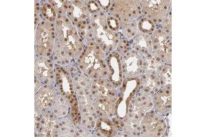 Immunohistochemical staining of human kidney with ZNF75A polyclonal antibody  shows moderate cytoplasmic and nuclear positivity in cells in tubules at 1:50-1:200 dilution. (ZNF75A Antikörper)