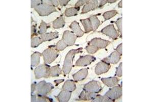 Formalin fixed and paraffin embedded human skeletal muscle reacted with DDX60L Antibody (C-term) followed by peroxidase conjugation of the secondary antibody and DAB staining. (DDX60L Antikörper  (C-Term))