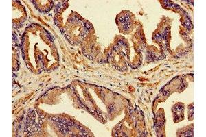 Immunohistochemistry of paraffin-embedded human prostate tissue using ABIN7145519 at dilution of 1:100 (MSMB Antikörper  (AA 27-107))