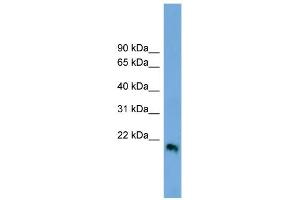 WB Suggested Anti-IFNB1 Antibody Titration:  0. (IFNB1 Antikörper  (Middle Region))