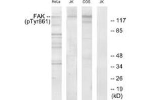 Western blot analysis of extracts from HeLa cells, Jurkat cells and COS cells, using FAK (Phospho-Tyr861) Antibody. (FAK Antikörper  (pTyr861))