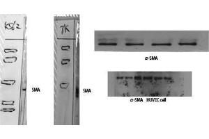 Western Blotting (WB) image for anti-alpha-SMA (N-Term) antibody (ABIN3180968) (alpha-SMA (N-Term) Antikörper)