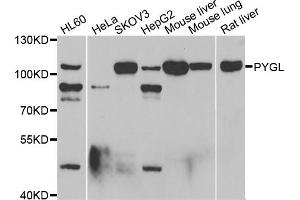 Western blot analysis of extracts of various cell lines, using PYGL antibody (ABIN5974053) at 1/1000 dilution. (PYGL Antikörper)