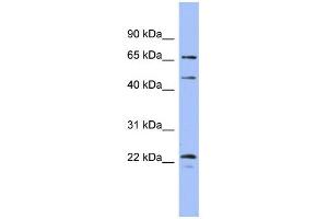 WB Suggested Anti-MAPK4 Antibody Titration: 0. (MAPK4 Antikörper  (Middle Region))